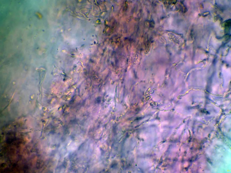 Baeomyces rufus 12 - Hifas base-001